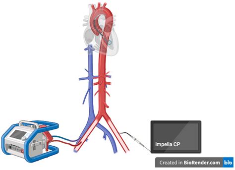 va ecmo vs impella